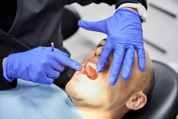 Best Broken or Chipped Tooth Repair in Alum Rock, CA
