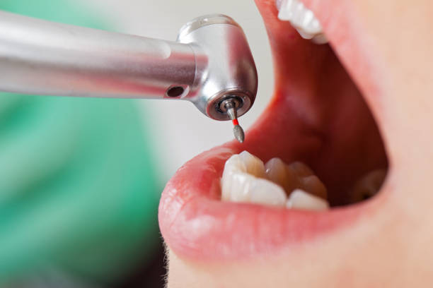 Best Emergency Orthodontic Repairs in Alum Rock, CA